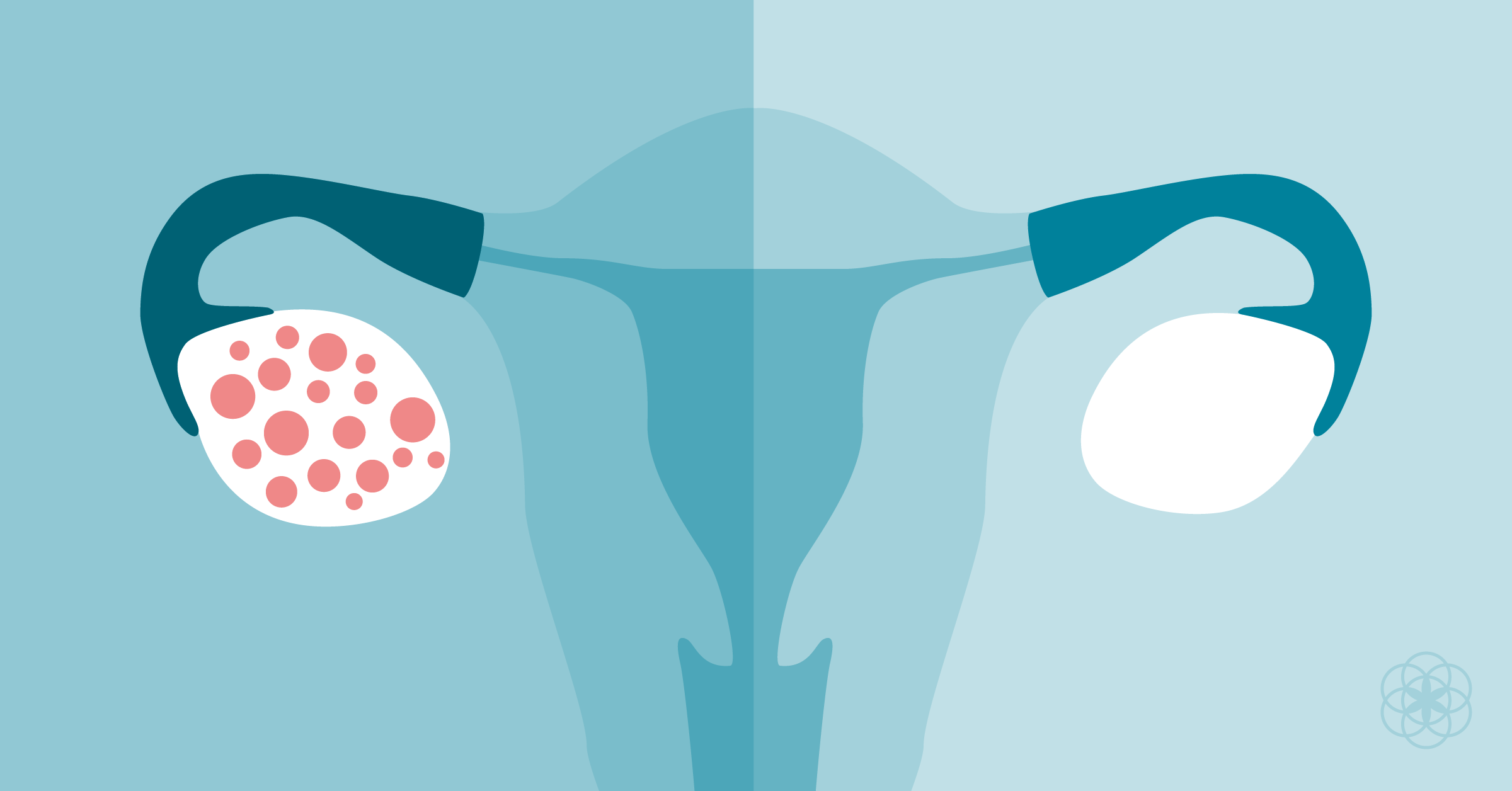 PCOS Management